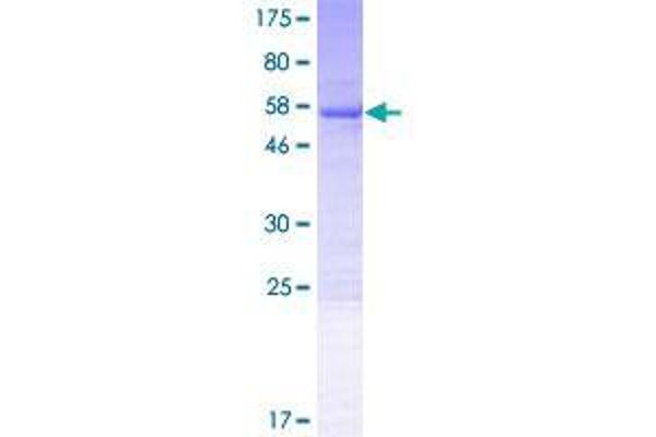 VPS37B Protein (AA 1-285) (GST tag)