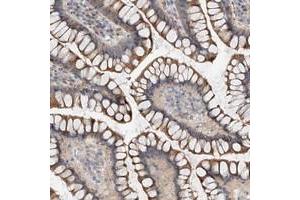 Immunohistochemical staining of human colon with MAGEE2 polyclonal antibody  shows moderate cytoplasmic positivity in glandular cells.