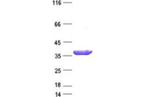 TCEAL2 Protein (DYKDDDDK Tag)