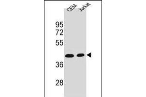 ADA Antibody (C-term) (ABIN1536621 and ABIN2843881) western blot analysis in CEM,Jurkat cell line lysates (35 μg/lane). (ADA antibody  (C-Term))