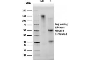 SDS-PAGE Analysis Purified CD68 Mouse Monoclonal Antibody (C68/2501). (CD68 antibody  (AA 150-221))
