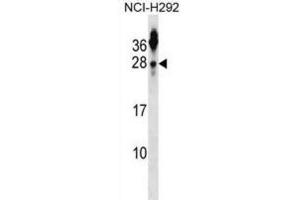 Western Blotting (WB) image for anti-Tetraspanin 2 (TSPAN2) antibody (ABIN2999038)