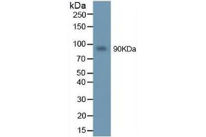 Western Blotting (WB) image for Matrix Metallopeptidase 9 (Gelatinase B, 92kDa Gelatinase, 92kDa Type IV Collagenase) (MMP9) ELISA Kit (ABIN6574164)