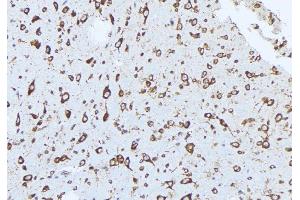 ABIN6277561 at 1/100 staining Mouse brain tissue by IHC-P. (ADAM9 antibody  (C-Term))