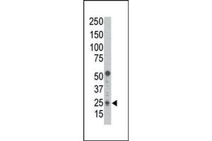 Image no. 1 for anti-BCL2 Binding Component 3 (BBC3) (BH3 Domain), (C-Term) antibody (ABIN356830) (PUMA antibody  (BH3 Domain, C-Term))