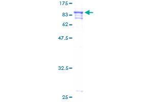 PRCC Protein (AA 1-491) (GST tag)