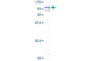 PRCC Protein (AA 1-491) (GST tag)