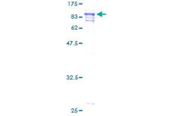 PRCC Protein (AA 1-491) (GST tag)