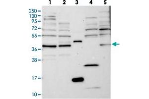 Western blot analysis of Lane 1: RT-4, Lane 2: U-251 MG, Lane 3: Human Plasma, Lane 4: Liver, Lane 5: Tonsil with FAXC polyclonal antibody  at 1:250-1:500 dilution.