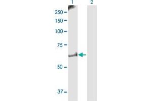 Western Blot analysis of MKKS expression in transfected 293T cell line by MKKS MaxPab polyclonal antibody. (MKKS antibody  (AA 1-570))