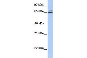 Western Blotting (WB) image for anti-Glutamic Pyruvate Transaminase (Alanine Aminotransferase) 2 (GPT2) antibody (ABIN2459251)