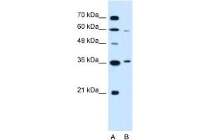 WB Suggested Anti-PARL Antibody Titration:  0.