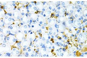 Immunohistochemistry of paraffin-embedded Mouse kidney using TAPBP Polyclonal Antibody at dilution of 1:200 (40x lens). (TAPBP antibody)
