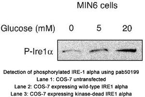 Image no. 2 for anti-Endoplasmic Reticulum To Nucleus Signaling 1 (ERN1) (pSer724) antibody (ABIN363508) (ERN1 antibody  (pSer724))