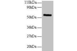 Western blot All lanes: MMP1 antibody at 2 μg/mL + 293T whole cell lysate Secondary Goat polyclonal to rabbit IgG at 1/10000 dilution Predicted band size: 55 kDa Observed band size: 55 kDa (MMP1 antibody  (AA 101-469))