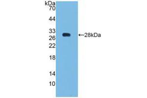 Western blot analysis of recombinant Human Bcl2. (Bcl-2 antibody  (AA 2-211))