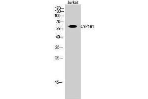 Western Blotting (WB) image for anti-Cytochrome P450, Family 1, Subfamily B, Polypeptide 1 (CYP1B1) (Internal Region) antibody (ABIN3184162) (CYP1B1 antibody  (Internal Region))