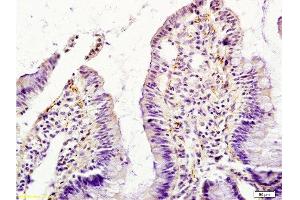 Immunohistochemistry (Paraffin-embedded Sections) (IHC (p)) image for anti-Colony Stimulating Factor 2 (Granulocyte-Macrophage) (CSF2) (AA 71-141) antibody (ABIN730723)