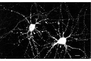 Immunocytochemistry/Immunofluorescence analysis using Mouse Anti-CaMKII Monoclonal Antibody, Clone 22B1 (ABIN361698 and ABIN361699). (CAMKII gamma antibody)