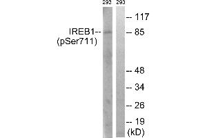 Immunohistochemistry analysis of paraffin-embedded human thyroid gland tissue using IREB1 (Phospho-Ser711) antibody. (Aconitase 1 antibody  (pSer711))