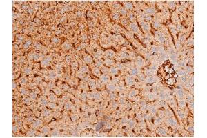 ABIN6267578 at 1/200 staining Mouse liver tissue sections by IHC-P.