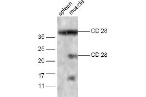 Mouse spleen probed with Rabbit Anti-CD28 Polyclonal Antibody Unconjugated  at 1:5000 for 90 min at 37˚C. (CD28 antibody  (AA 19-69))