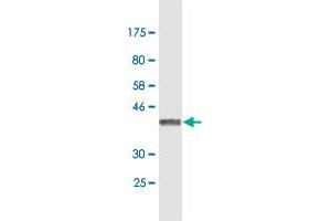 Western Blotting (WB) image for anti-NADH Dehydrogenase (Ubiquinone) 1 alpha Subcomplex, 5, 13kDa (NDUFA5) (AA 1-116) antibody (ABIN948173)