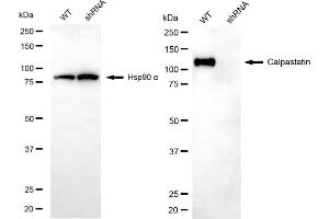 Western blotting analysis using calpastatin antibody (ABIN7797850). (Calpastatin antibody)