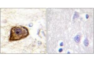 Immunohistochemistry analysis of paraffin-embedded human brain, using PDGFR beta (Phospho-Tyr1021) Antibody. (PDGFRB antibody  (pTyr1021))