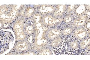 Detection of SMAD3 in Human Kidney Tissue using Monoclonal Antibody to SMAD family member 3 (SMAD3) (SMAD3 antibody  (AA 231-425))