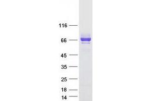 Western Blotting (WB) image for Signal-Regulatory Protein alpha (SIRPA) (Transcript Variant 2) protein (Myc-DYKDDDDK Tag) (ABIN2713467)