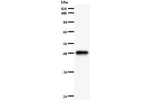 Western Blotting (WB) image for anti-Formin-Like 1 (FMNL1) antibody (ABIN931116) (Formin-Like 1 antibody)