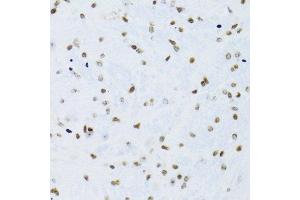 Immunohistochemistry (Paraffin-embedded Sections) (IHC (p)) image for anti-Nuclear Factor of kappa Light Polypeptide Gene Enhancer in B-Cells 2 (NFKB2) (AA 690-899) antibody (ABIN3017388)