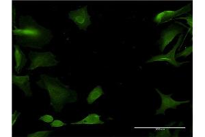 Immunofluorescence of monoclonal antibody to CYP1A2 on HeLa cell. (CYP1A2 antibody  (AA 211-310))