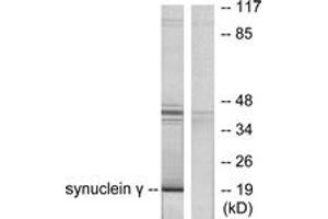 Western blot analysis of extracts from HT29 cells, using Synuclein gamma Antibody. (SNCG antibody  (AA 78-127))