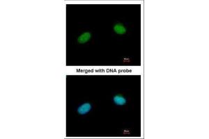 ICC/IF Image Immunofluorescence analysis of paraformaldehyde-fixed HeLa, using XRCC3, antibody at 1:200 dilution. (XRCC3 antibody  (C-Term))