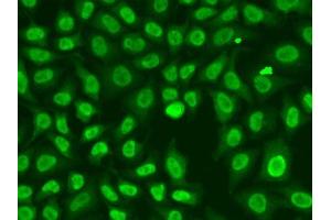 Immunofluorescence analysis of A549 cells using CHEK2 antibody. (CHEK2 antibody  (AA 1-220))