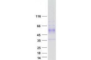 Western Blotting (WB) image for WD Repeat Domain 83 (wdr83) (Transcript Variant 1) protein (Myc-DYKDDDDK Tag) (ABIN2726271)