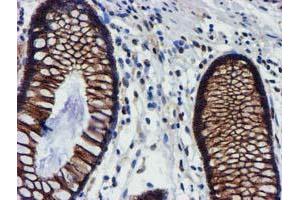 Image no. 7 for anti-Makorin Ring Finger Protein 1 (MKRN1) antibody (ABIN1499486)