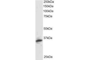 Image no. 1 for anti-Proteasome (Prosome, Macropain) Inhibitor Subunit 1 (PI31) (PSMF1) (C-Term), (Isoform 1) antibody (ABIN374303) (PSMF1 antibody  (C-Term, Isoform 1))