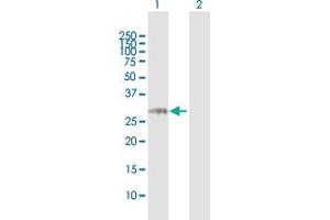 Western Blot analysis of NCR3 expression in transfected 293T cell line by NCR3 MaxPab polyclonal antibody. (NCR3 antibody  (AA 1-201))