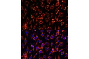 Immunofluorescence (IF) image for anti-Malignant T Cell Amplified Sequence 1 (MCTS1) (AA 1-181) antibody (ABIN6143657)