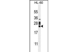 CSF2 Antibody (Center) (ABIN654647 and ABIN2844343) western blot analysis in HL60 cell line lysates (35 μg/lane). (GM-CSF antibody  (AA 59-85))
