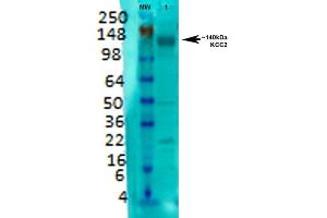 Western Blot analysis of Rat brain membrane lysate showing detection of KCC2 protein using Mouse Anti-KCC2 Monoclonal Antibody, Clone S1-12 (ABIN1027708).