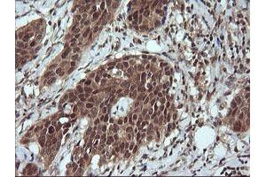 Image no. 6 for anti-Leucine Zipper and CTNNBIP1 Domain Containing (LZIC) antibody (ABIN1499239) (LZIC antibody)