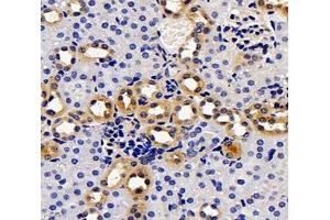 Immunohistochemistry analysis of paraffin-embedded mouse kidney using,PKD2L1 (ABIN7075125) at dilution of 1: 3400 (PKD2L1 antibody)