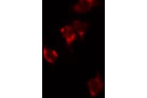 ABIN6272351 staining HuvEc by IF/ICC. (MRPL48 antibody  (Internal Region))