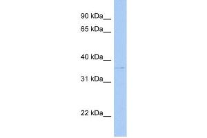 WB Suggested Anti-SULT1C2 Antibody Titration:  0. (SULT1C2 antibody  (C-Term))