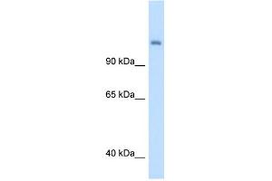 CPS1 antibody used at 5 ug/ml to detect target protein. (CPS1 antibody  (Middle Region))