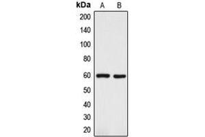 Western blot analysis of TRP2 expression in A375 (A), Y79 (B) whole cell lysates.